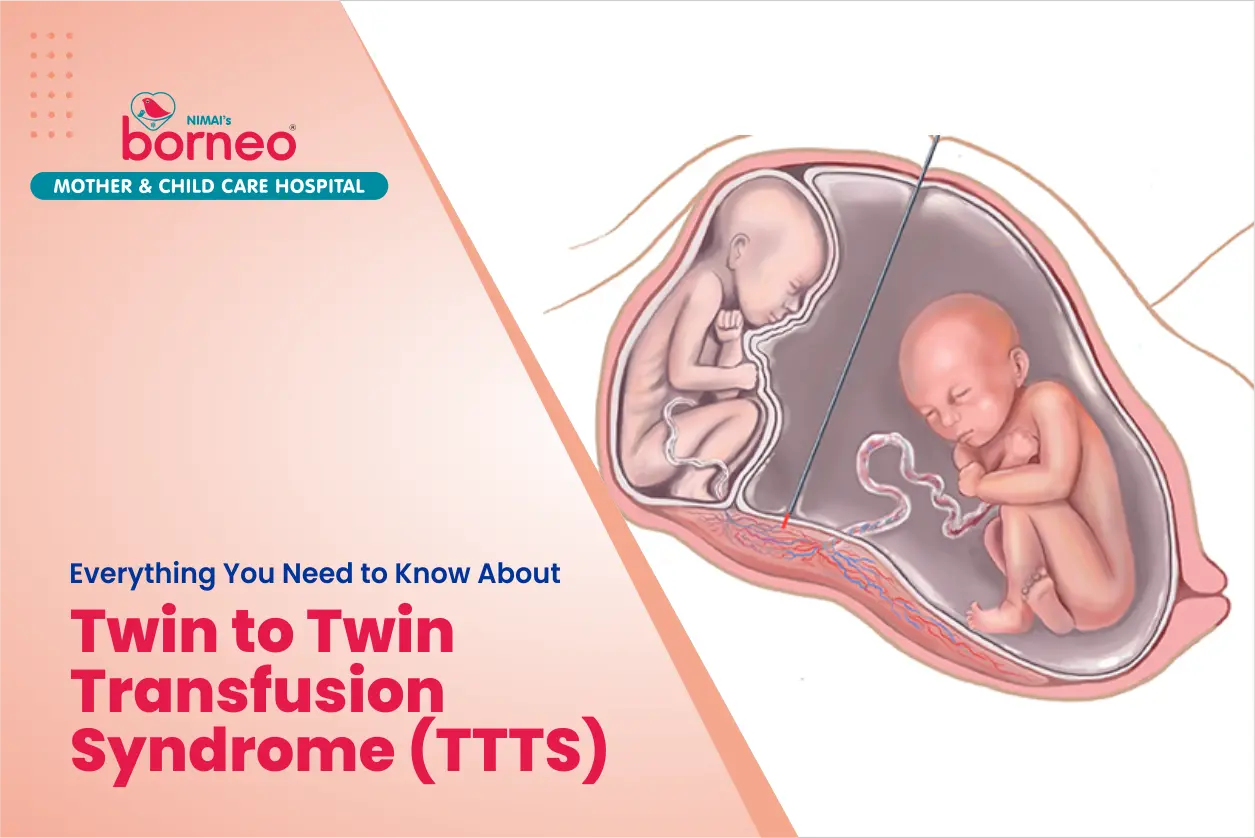 Twin to Twin Transfusion Syndrome